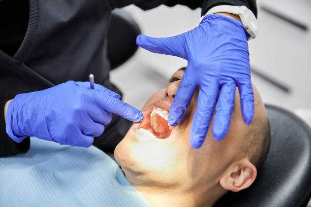 Best Emergency Dentist for Lost Fillings or Crowns in Rome City, IN